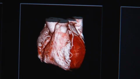 Color 3D view CT scan of patients internal organs zoom out of screen Stock Footage 115503478