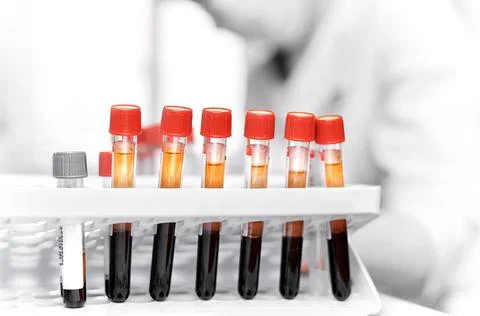 Color-coded tubes of blood in the lab. Stock Photos