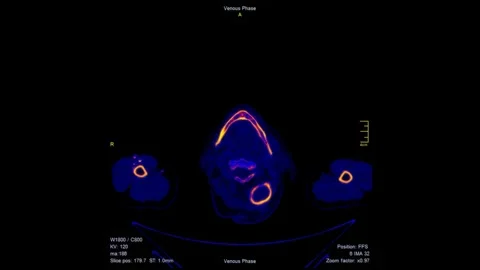 Colored Computed Tomography Scan of Full Body Medical CT Scan Animation Stock Footage 321009841