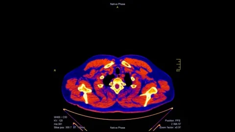 Colored Computed Tomography Scan of Full Body Medical CT Scan Animation Stock Footage 321010042