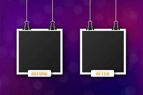 Colorful before and after frames. Vector illustration. Vector template. Design イラスト素材