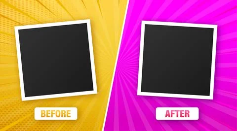 Colorful before and after frames. Vector illustration. Vector template. Design 库存插图