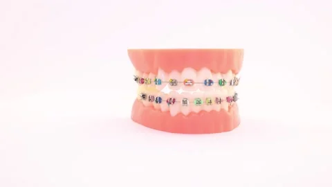 Colorful  brackets at teeth isolated on a white background Video stock 144695870