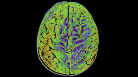 Colorful changing scan of human brain Video stock 49070169