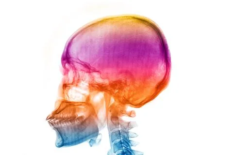 Colorful skull human x-rays image Stock Illustration