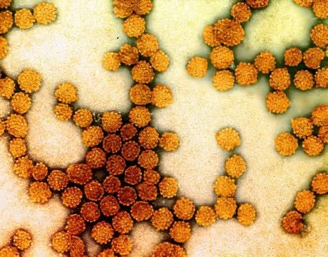  Colorized electron micrograph of HPV virus particles (gold and red) harve... Foto stock