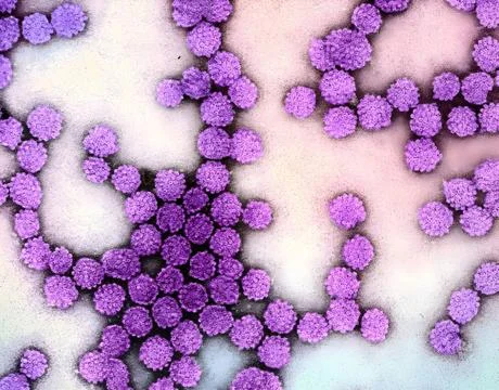  Colorized electron micrograph of HPV virus particles (magenta) harvested ... Stock Photos
