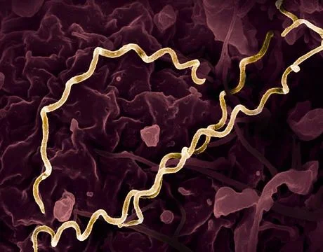  Colorized electron micrograph of Treponema pallidum, the bacteria that ca... Stock Photos
