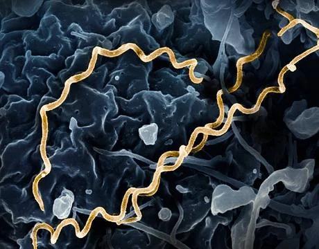  Colorized electron micrograph of Treponema pallidum, the bacteria that ca... Stock Photos