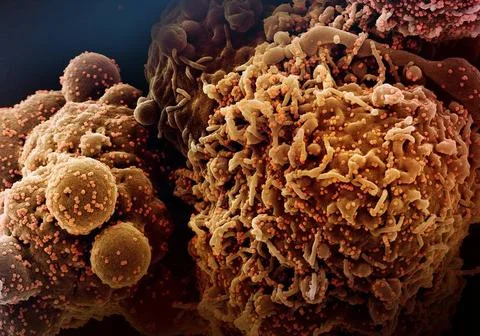  Colorized scanning electron micrograph of a cell (brown) infected with th... Stock Photos