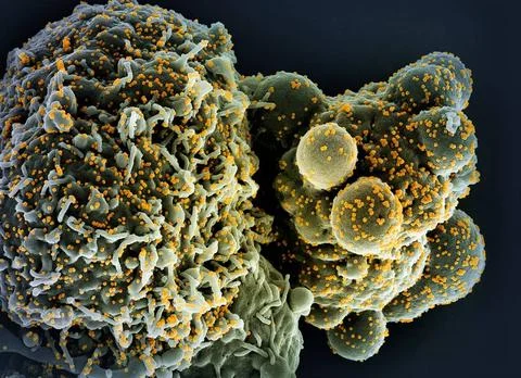  Colorized scanning electron micrograph of a cell (green) infected with th... Stock Photos
