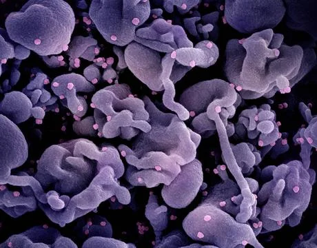  Colorized scanning electron micrograph of a cell (purple) infected with t... Stock Photos