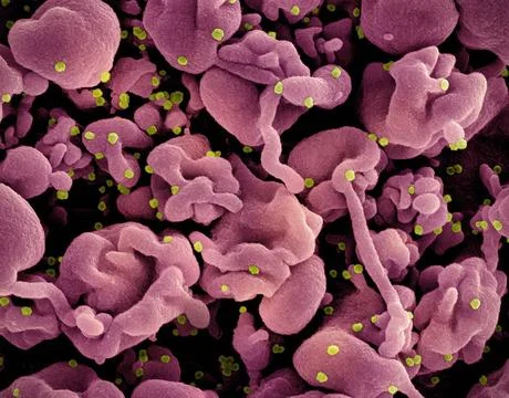  Colorized scanning electron micrograph of a cell (pink) infected with the... Stock Photos