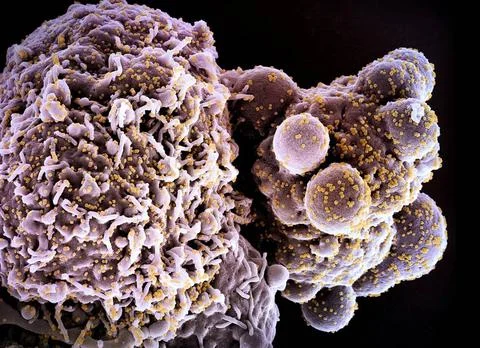  Colorized scanning electron micrograph of a cell (pink) infected with the... Stock Photos
