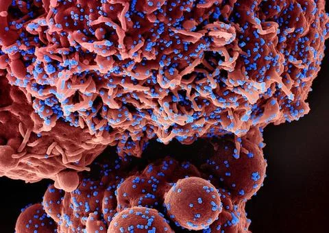  Colorized scanning electron micrograph of a cell (red) infected with the ... Stock Photos