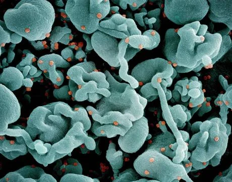  Colorized scanning electron micrograph of a cell (green) infected with th... Stock Photos