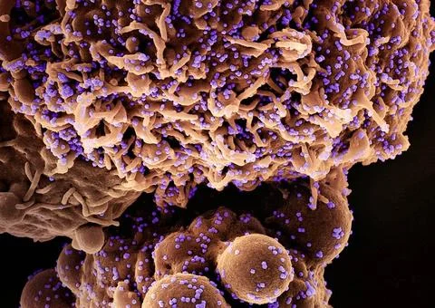  Colorized scanning electron micrograph of a cell (brown) infected with th... Stock Photos