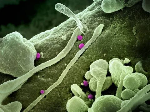  Colorized scanning electron micrograph of Crimean-Congo hemorrhagic fever... Stock Photos