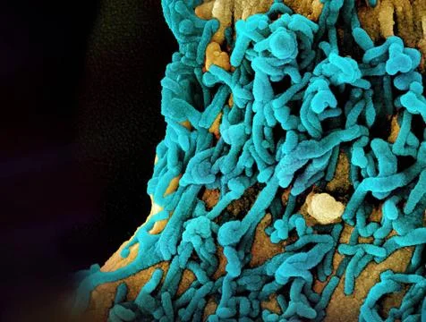  Colorized scanning electron micrograph of Marburg virus particles (teal) ... Stock Photos