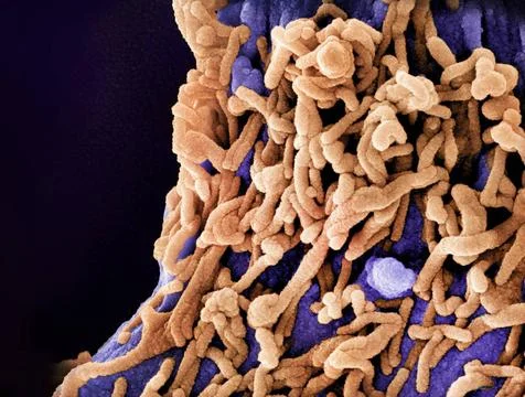  Colorized scanning electron micrograph of Marburg virus particles (orange... Stock Photos