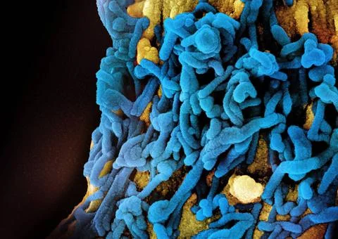  Colorized scanning electron micrograph of Marburg virus particles (blue) ... Stock Photos