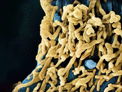  Colorized scanning electron micrograph of Marburg virus particles (yellow... Stock Photos