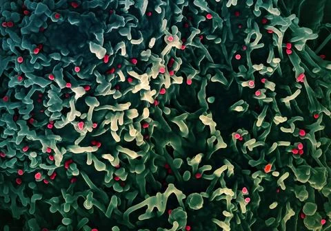 Colorized scanning electron micrograph of mpox virus (red) on the surface... Stock Photos