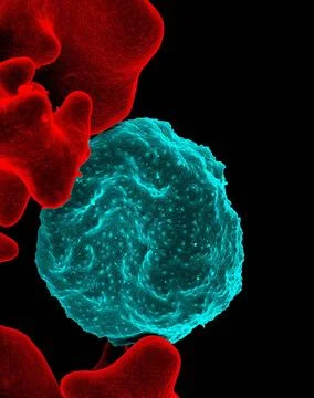  Colorized scanning electron micrograph of red blood cell infected with ma... Stock Photos