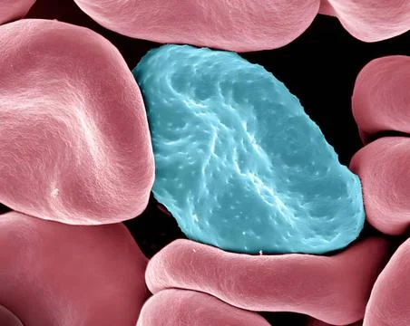 Colorized scanning electron micrograph of red blood cell infected with ma... Stock-Fotos