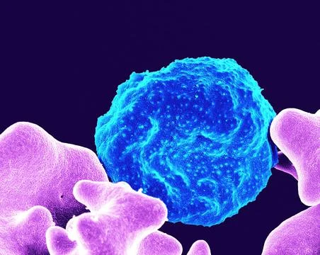  Colorized scanning electron micrograph of red blood cell infected with ma... Stock-Fotos