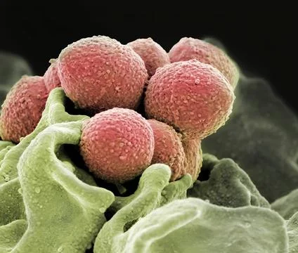  A colorized scanning electron microscope image of Group A Streptococcus (... Stock Photos