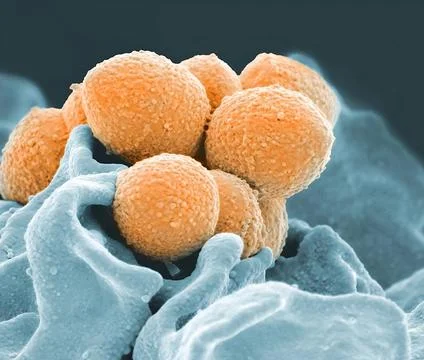  A colorized scanning electron microscope image of Group A Streptococcus (... Stock Photos