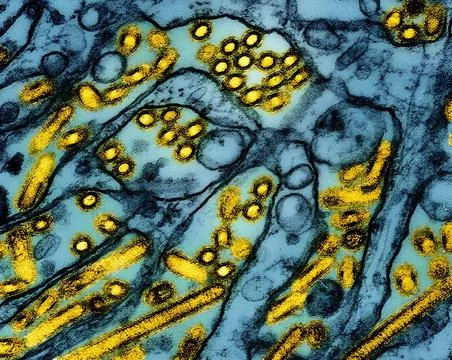 Colorized transmission electron micrograph of avian influenza A H5N1 viru... Stock Photos
