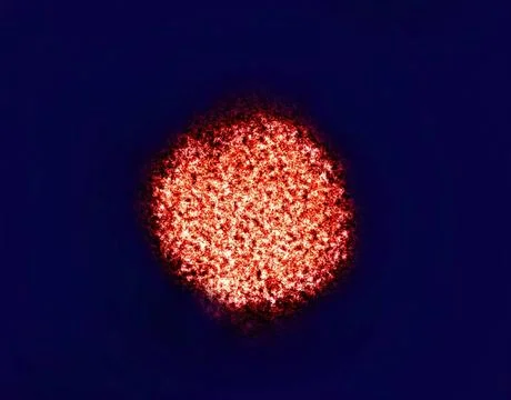  Colorized transmission electron micrograph of a hepatitis C virion. Micro... Stock Photos