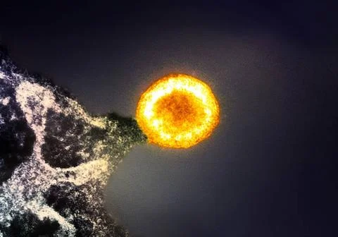  Colorized transmission electron micrograph of an HIV-1 virus particle (ye... Stock Photos