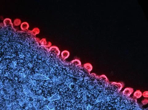  Colorized transmission electron micrograph of HIV-1 virus particles (red)... Stock Photos
