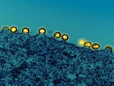  Colorized transmission electron micrograph of HIV-1 virus particles (yell... Stock Photos
