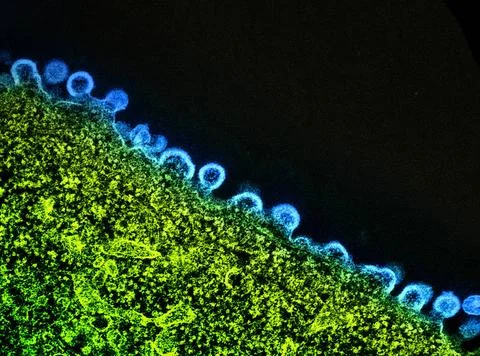  Colorized transmission electron micrograph of HIV-1 virus particles (blue... Stock Photos