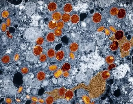  Colorized transmission electron micrograph of mpox virus particles (red a... Stock Photos