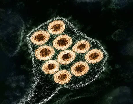 Colorized transmission electron micrograph of rabies virus particles (ora... Stock Photos