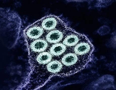  Colorized transmission electron micrograph of rabies virus particles (gre... Stock Photos