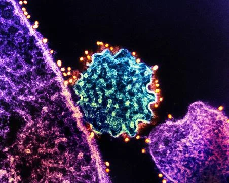  Colorized transmission electron micrograph of a single Nipah virus partic... Stock Photos