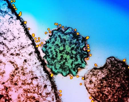  Colorized transmission electron micrograph of a single Nipah virus partic... Stock Photos