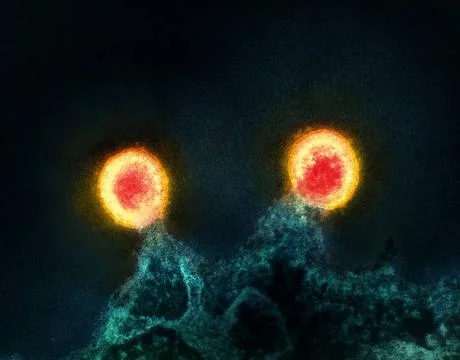  Colorized transmission electron micrograph of two HIV-1 virus particles (... Stock Photos