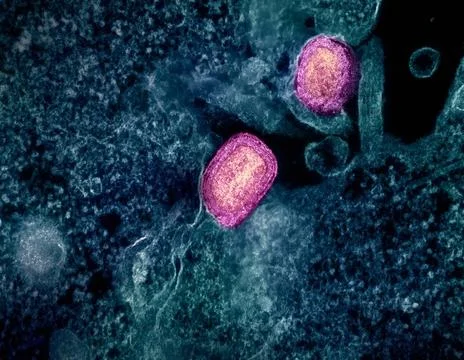  Colorized transmission electron micrograph of two mature mpox virus parti... Stock Photos