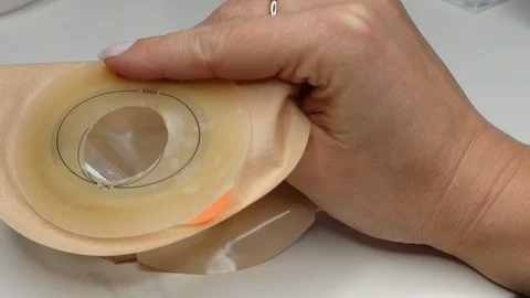 Colostomy bag, supply needed after colostomy surgery. Stoma bag ready to use Stock Footage 122108254