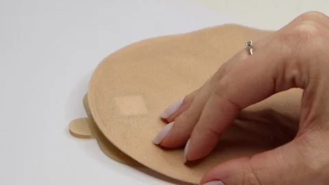 Colostomy bag, supply needed after colostomy surgery. Ostomy pouch. Stock Footage 122120231