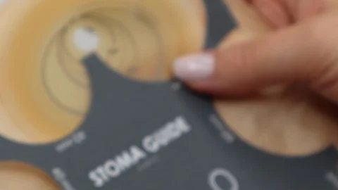 Colostomy bag, supply needed after colostomy surgery. Using stoma guide. Stock Footage 122126829