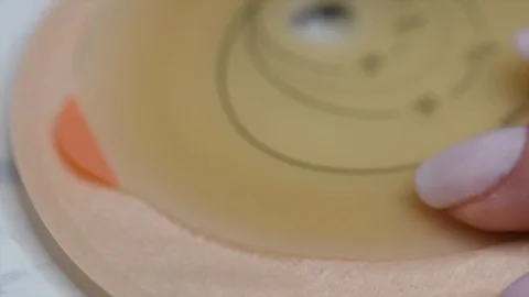 Colostomy bag, supply needed after colostomy surgery - colon cancer treatment. Video stock 122316595