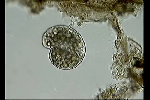 Colpoda Video stock 1183847